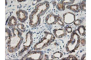 Image no. 6 for anti-Adenylate Kinase 4 (AK4) antibody (ABIN1496526)