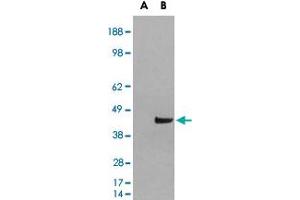 HEK293 overexpressing SNX16 and probed with SNX16 polyclonal antibody  (mock transfection in first lane), tested by Origene. (SNX16 anticorps)