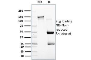 SDS-PAGE Analysis Purified CD257 Mouse Monoclonal Antibody (C257/1638). (BAFF anticorps)