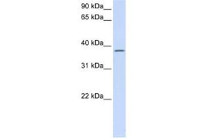 C21ORF91 antibody used at 1 ug/ml to detect target protein. (C21orf91 anticorps  (Middle Region))
