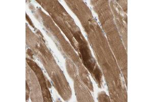 Immunohistochemical staining (Formalin-fixed paraffin-embedded sections) of human skeletal muscle with JPH1 polyclonal antibody  shows strong cytoplasmic positivity in myocytes.