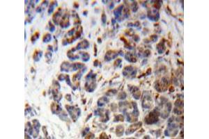 Used in DAB staining on fromalin fixed paraffin-embedded Pancreas tissue