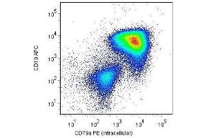 Intracellular staining of CD79a with anti-CD79a (HM57) PE (gated on leukemic blast cells) in a patient with childhood B-precursor ALL.
