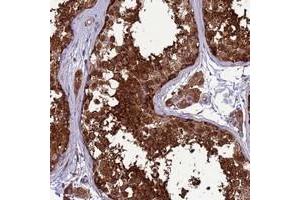 Immunohistochemical staining of human testis with ZC3HAV1 polyclonal antibody  shows strong cytoplasmic positivity in cells in seminiferus ducts at 1:20-1:50 dilution. (ZC3HAV1 anticorps)
