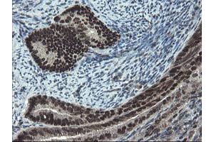 Image no. 3 for anti-Ubiquitin-Conjugating Enzyme E2E 3 (UBE2E3) antibody (ABIN1501618)