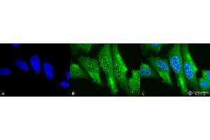 Immunocytochemistry/Immunofluorescence analysis using Mouse Anti-HO-1 Monoclonal Antibody, Clone 1F12-A6 . (HMOX1 anticorps  (AA 1-30) (PerCP))