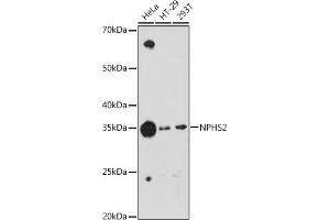 Western blot analysis of extracts of various cell lines, using NPHS2 antibody (ABIN1680543, ABIN7101468, ABIN7101469 and ABIN7101470) at 1:1000 dilution.