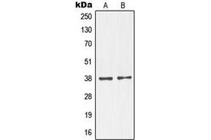 Western blot analysis of NKX2-1 expression in MAD109 (A), HeLa (B), SP2/0 (C) whole cell lysates. (NKX2-1 anticorps  (N-Term))