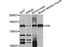 Western blot analysis of extracts of various cell lines, using AGL antibody (ABIN4902856) at 1:1000 dilution. (AGL anticorps)