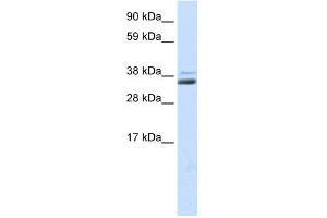 WB Suggested Anti-SFRP1 Antibody Titration:  0. (SFRP1 anticorps  (Middle Region))