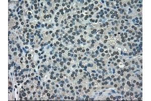 Immunohistochemical staining of paraffin-embedded Ovary tissue using anti-NEK6mouse monoclonal antibody. (NEK6 anticorps)