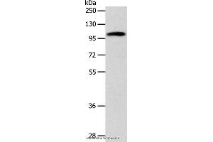 Western blot analysis of 293T cell, using ADCY1 Polyclonal Antibody at dilution of 1:1000 (ADCY1 anticorps)