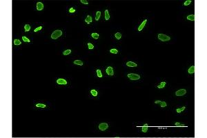 anti-Heterogeneous Nuclear Ribonucleoprotein A2/B1 (HNRNPA2B1) (AA 1-249) antibody