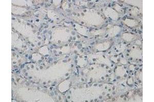Immunohistochemical staining of formalin-fixed paraffin-embedded human kidney tissue showing cytoplasmic and nuclear staining with PAWR polyclonal antibody  at 1 : 100 dilution. (PAWR anticorps  (C-Term))
