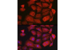 Immunofluorescence analysis of  cells using GAMT Rabbit pAb (ABIN6130447, ABIN6140950, ABIN6140951 and ABIN6222280) at dilution of 1:200 (40x lens).