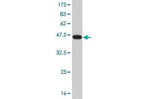 Western Blot detection against Immunogen (36. (ERN1 anticorps  (AA 401-500))