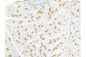 ABIN6258139 and ABIN6275929 at 1/100 staining Rat skin tissue by IHC-P.