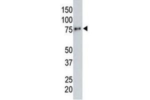 Anti-HA tag antibody testing a tagged recombinant protein. (HA-Tag anticorps)