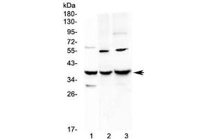 Western blot testing of 1) rat liver, 2) mouse Neuro-2a and 3) mouse HEPA1-6 lysate with IGFBP2 antibody at 0. (IGFBP2 anticorps  (AA 35-304))