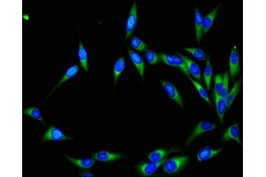 Immunofluorescent analysis of Hela cells using ABIN7161130 at dilution of 1:100 and Alexa Fluor 488-congugated AffiniPure Goat Anti-Rabbit IgG(H+L)
