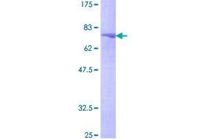 Image no. 1 for Polymerase (DNA Directed), delta 2, Accessory Subunit (POLD2) (AA 1-469) protein (GST tag) (ABIN1315626)