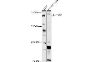 Western blot analysis of extracts of various cell lines, using TSC2 antibody (ABIN1683176, ABIN5663676 and ABIN7101314) at 1:1000 dilution. (Tuberin anticorps)