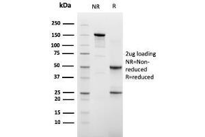 SDS-PAGE Analysis of Purified Cadherin 16 Mouse Monoclonal Antibody (CDH16/2448). (Cadherin-16 anticorps  (AA 371-507))