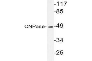 Western blot (WB) analysis of CNPase antibody in extracts from HUVEC cells. (Cnpase anticorps)