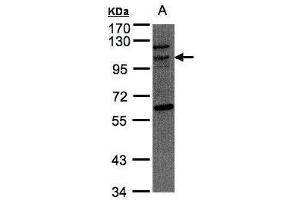 WB Image Sample(30 μg of whole cell lysate) A:Raji, 7. (TAO Kinase 3 anticorps)