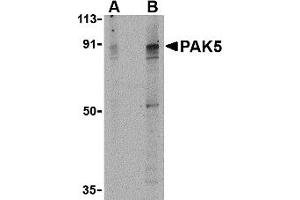 Western Blotting (WB) image for anti-P21 Protein (Cdc42/Rac)-Activated Kinase 7 (PAK7) (Middle Region) antibody (ABIN1031031) (PAK7 anticorps  (Middle Region))
