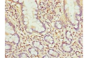 Immunohistochemistry of paraffin-embedded human small intestine tissue using ABIN7142439 at dilution of 1:100 (MRPL51 anticorps  (AA 32-128))