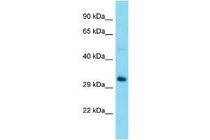 Western Blotting (WB) image for anti-Ribosomal RNA Processing 15 Homolog (RRP15) (Middle Region) antibody (ABIN2774509) (RRP15 anticorps  (Middle Region))