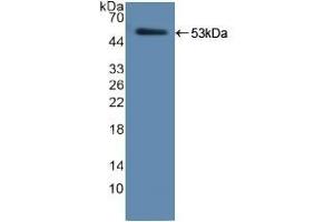 Detection of Recombinant ELA2, Human using Polyclonal Antibody to Neutrophil Elastase (NE) (ELANE anticorps  (AA 30-247))