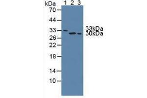 Western blot analysis of (1) Human Serum, (2) Human Lung Tissue and (3) Human A549 Cells.