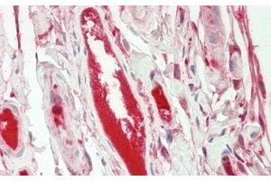 Detection of FGA in Human Small Intestine Tissue using Polyclonal Antibody to Fibrinogen Alpha Chain (FGA)
