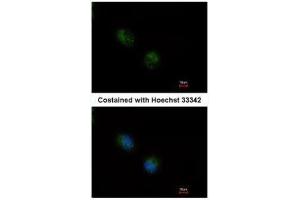 ICC/IF Image Immunofluorescence analysis of methanol-fixed A549, using STMN2, antibody at 1:500 dilution. (STMN2 anticorps  (N-Term))