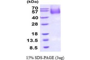 SDS-PAGE (SDS) image for CD34 (CD34) (AA 32-290) protein (His tag) (ABIN5854710) (CD34 Protein (CD34) (AA 32-290) (His tag))