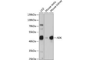 Western blot analysis of extracts of various cell lines, using ADK antibody (ABIN7265463) at 1:1000 dilution. (ADK anticorps  (AA 200-345))