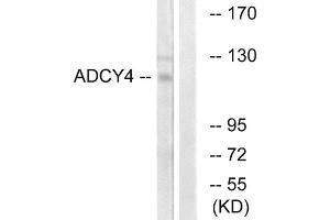 Western blot analysis of extracts from Jurkat cells, using ADCY4 antibody. (ADCY4 anticorps  (Internal Region))