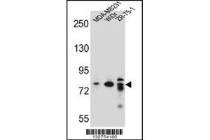 Western blot analysis in MDA-MB231,WiDr,ZR-75-1 cell line lysates (35ug/lane).