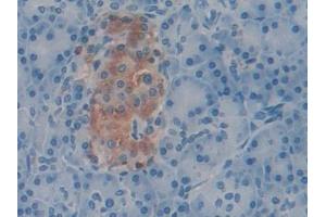 Detection of F5 in Human Pancreas Tissue using Polyclonal Antibody to Coagulation Factor V (F5)