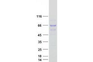 Validation with Western Blot