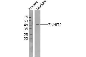 Mouse bladder lysates probed with ZNHIT2 Polyclonal Antibody, Unconjugated  at 1:300 dilution and 4˚C overnight incubation.