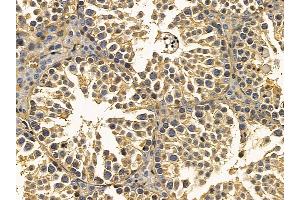 pan Actin Mouse Monoclonal Antibody at 1/100 staining mouse testis tissue by IHC-P. (Actin anticorps  (pan))