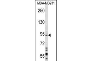 D1L1 Antibody (N-term) (ABIN656281 and ABIN2845591) western blot analysis in MDA-M cell line lysates (35 μg/lane). (MAD1L1 anticorps  (N-Term))