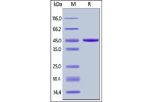 Human IL-21, Fc Tag on  under reducing (R) condition. (IL-21 Protein (AA 30-162) (Fc Tag))