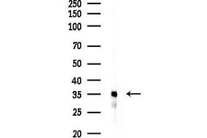 Western blot analysis of lysates from EC304 cells, using TAS2R9 Antibody at 1/1000 dilution.
