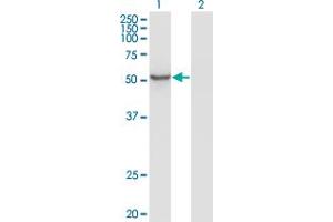Western Blot analysis of ZNF70 expression in transfected 293T cell line by ZNF70 monoclonal antibody (M01), clone 1D8. (ZNF70 anticorps  (AA 1-446))