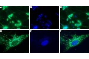 Expression of neuropeptide Y4 receptor in rat DRG - Immunocytochemical staining of a primary culture of rat dorsal root ganglion (DRG) neurons. (NPY4R anticorps  (Intracellular))