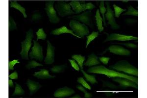 Immunofluorescence of monoclonal antibody to S100A10 on HeLa cell.